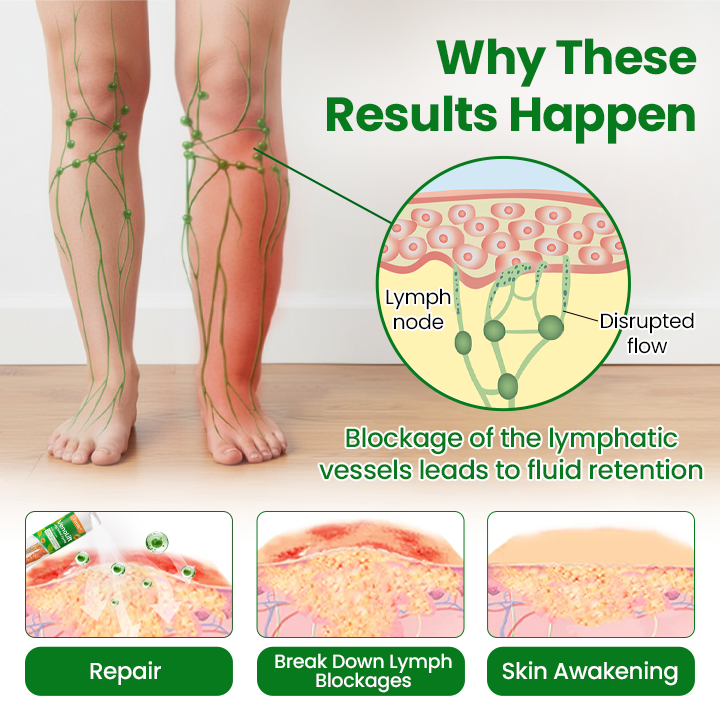 Timilk® VenoLift Leg Relief Spray