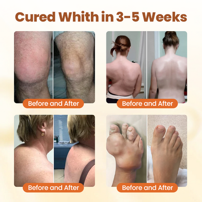 Biancat® Premium Curcumin Pain Relief Gel