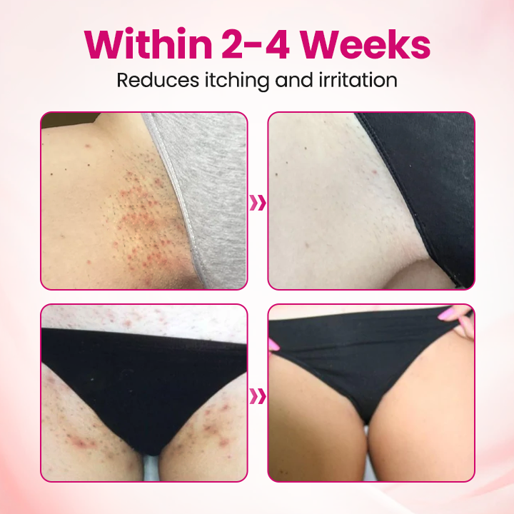 Timilk® IntiDefend Anti-HPV Interferon Gel