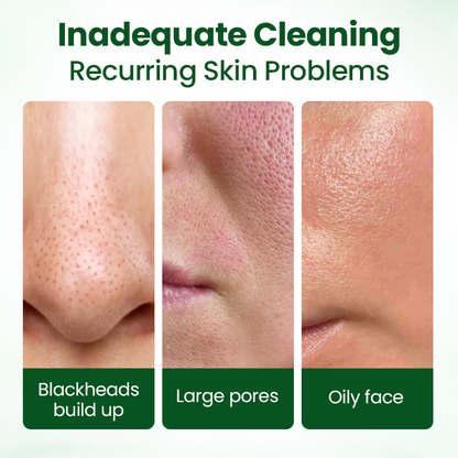 Biancat® PoreMelt Avocado Acid Mask